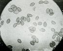 Inocybe rimosa image