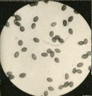 Hypholoma echiniceps image