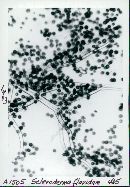 Scleroderma flavidum image