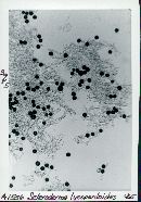 Scleroderma lycoperdoides image