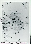 Scleroderma lycoperdoides image