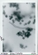 Disciseda candida image