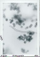 Disciseda candida image