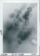 Disciseda candida image