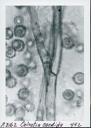 Calvatia candida image