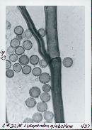 Lycoperdon glabellum image