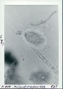 Scutellinia asperrima image