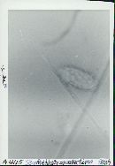 Scutellinia asperrima image