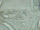 Eremiomyces echinulatus image