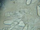 Eremiomyces echinulatus image