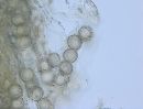 Eremiomyces echinulatus image