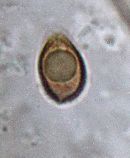 Ganoderma sessile image