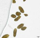 Berkleasmium conglobatum image