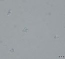 Cenangium ferruginosum image