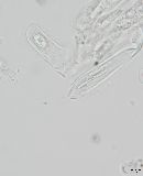 Cenangium ferruginosum image