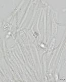 Cenangium ferruginosum image