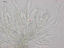Chlorosplenium chlora image