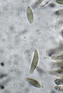 Cudoniella acicularis image