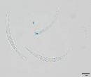 Dermea balsamea image