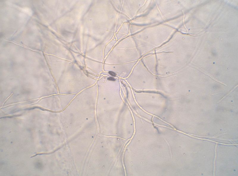 Rosellinia corticium image