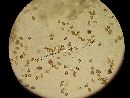 Agaricus placomyces image