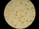 Ganoderma sessile image