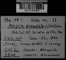 Arcyria denudata image