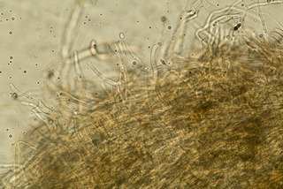 Bulgariella pulla image