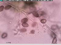 Pseudoperonospora cannabina image