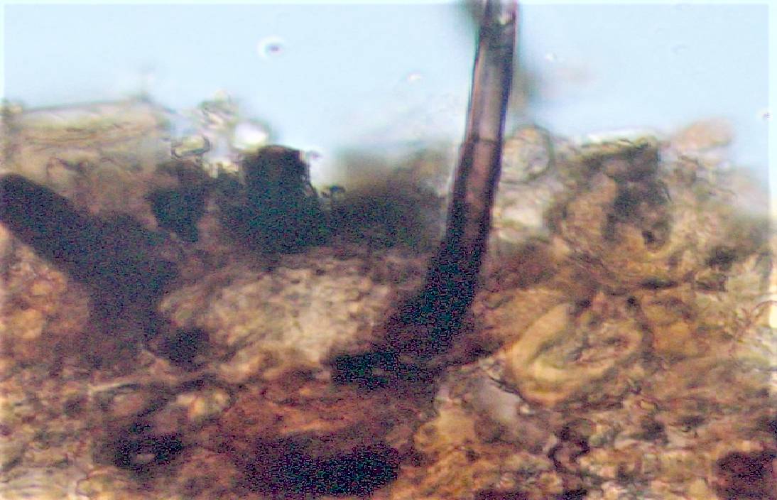 Pyrenochaeta fraxinina image