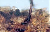Pyrenochaeta fraxinina image