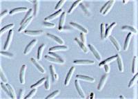 Pyrenochaeta fraxinina image