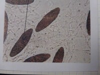 Nectria decora image
