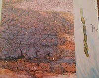 Biporispora europaea image