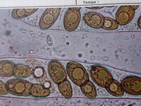 Splanchospora ampullacea image