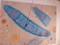 Nectria decora image