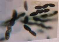 Xylaria squamulosa image