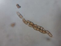 Chaetosphaerella fusca image