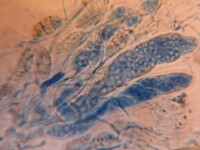 Gloniopsis praelonga image