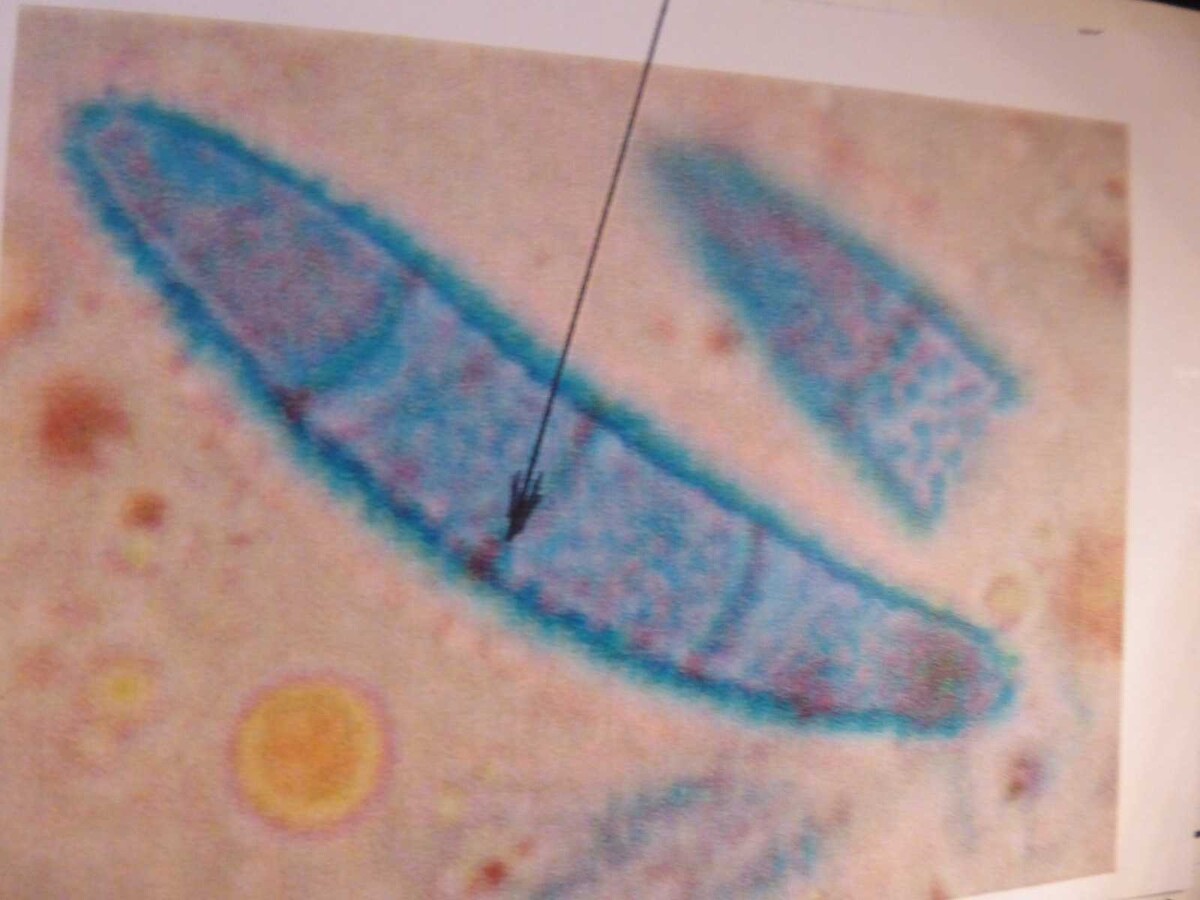 Nectria decora image