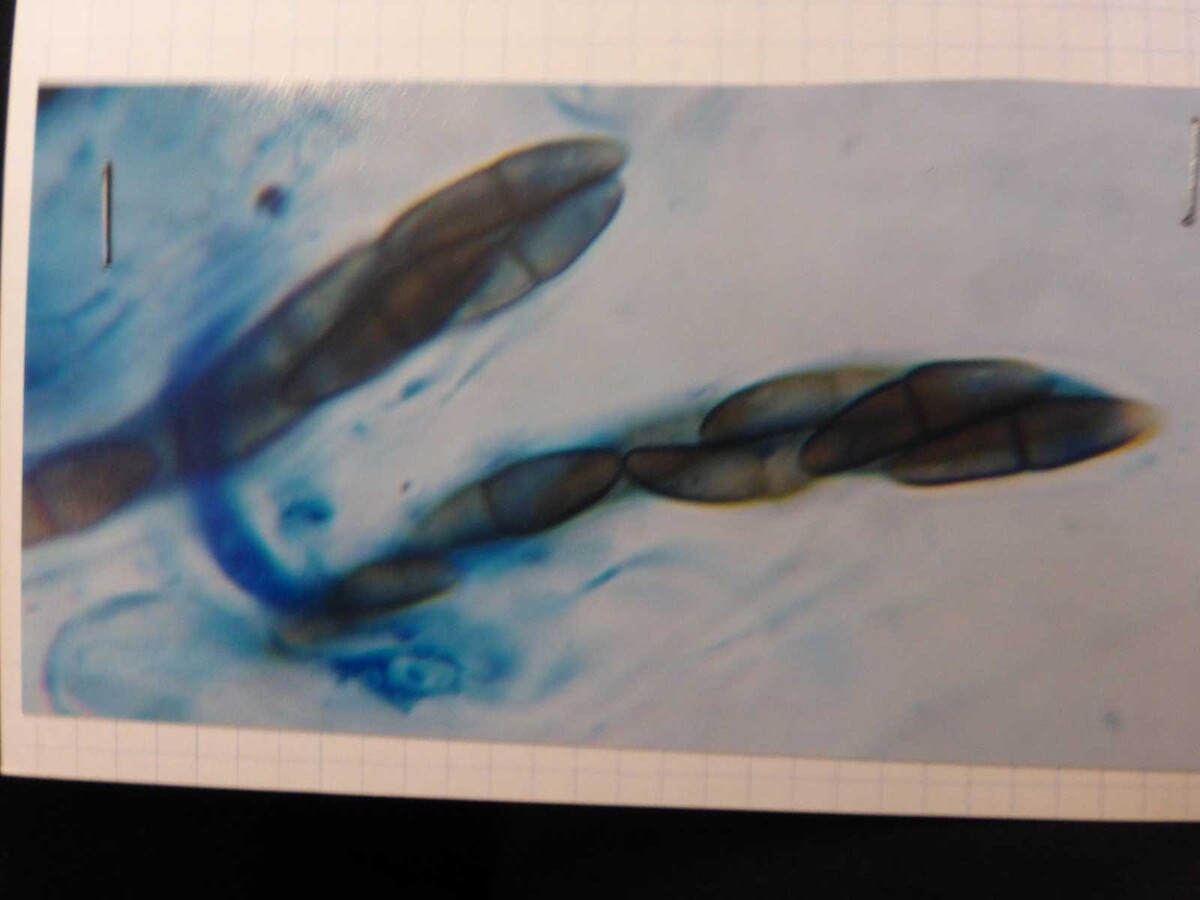 Trematosphaeria image