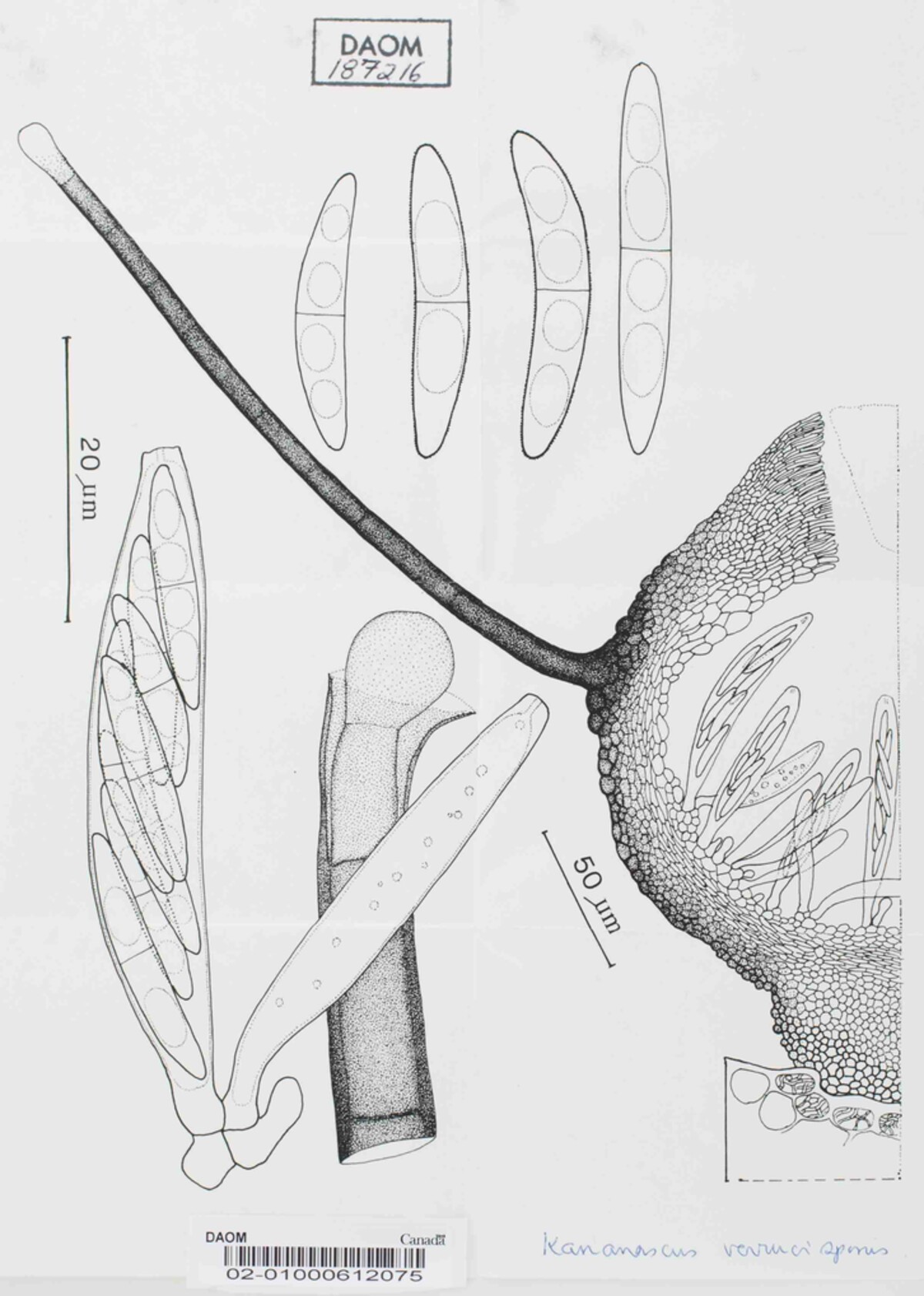 Kananascus verrucisporus image