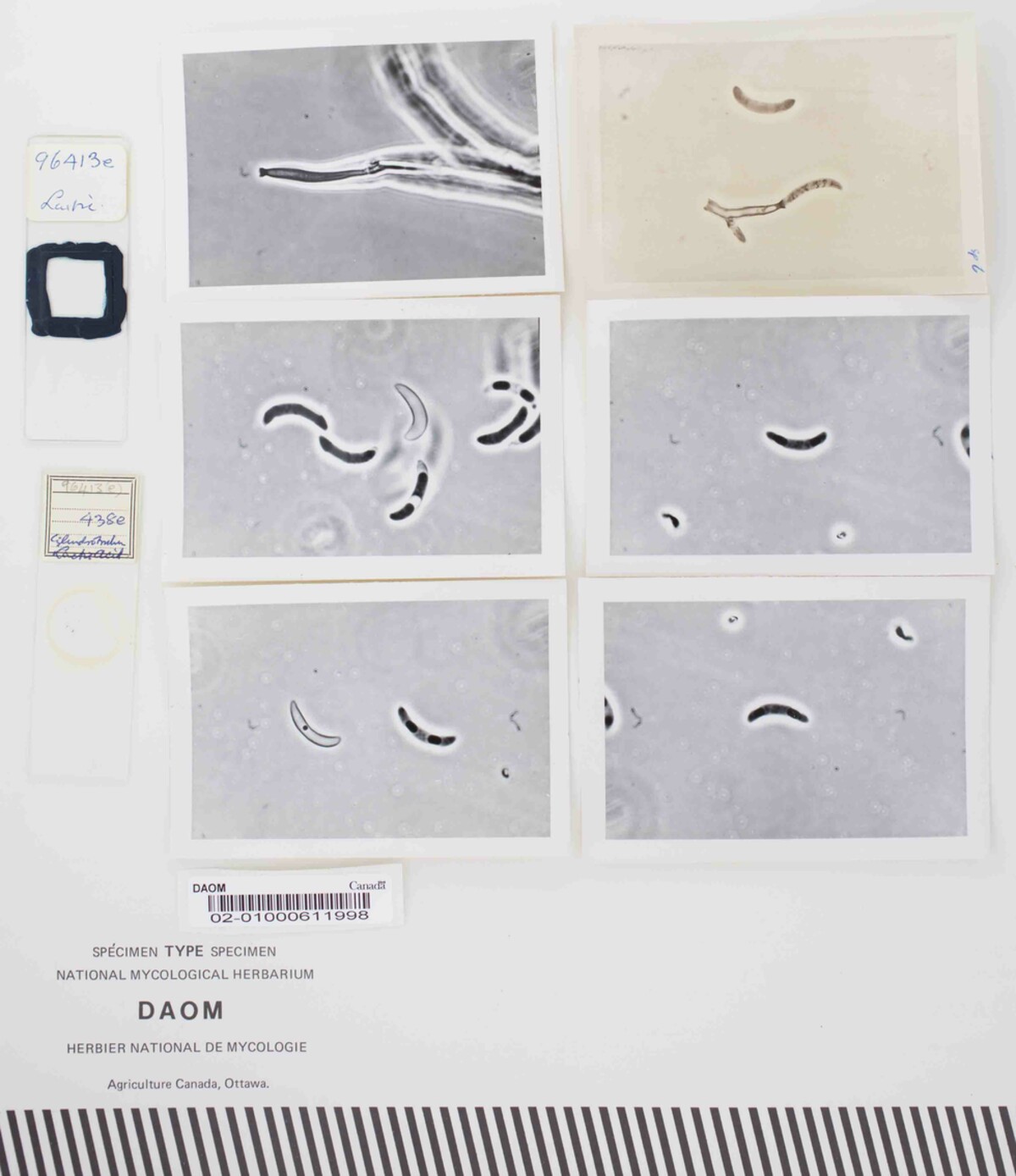 Dictyochaeta botulispora image