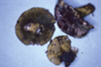 Hypomyces luteovirens image