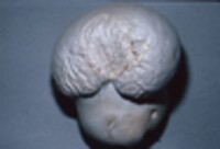 Calvatia craniiformis image