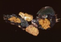 Tremella encephala image