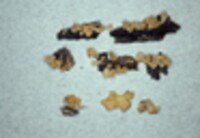 Dacryopinax spathularia image