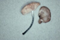 Pluteus salicinus image