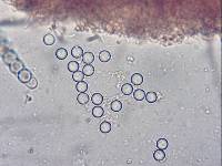 Pulvinula archeri image