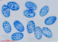 Scutellinia vitreola image